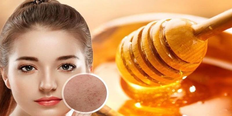 Tại Sao Mật Ong Có Thể Trị Mụn