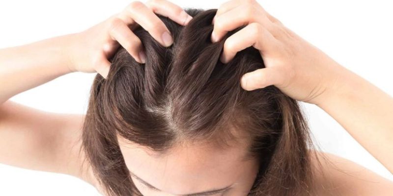 Bệnh Nấm Da Đầu Ở Người Lớn – Nguyên Nhân, Triệu Chứng Và Cách Điều Trị