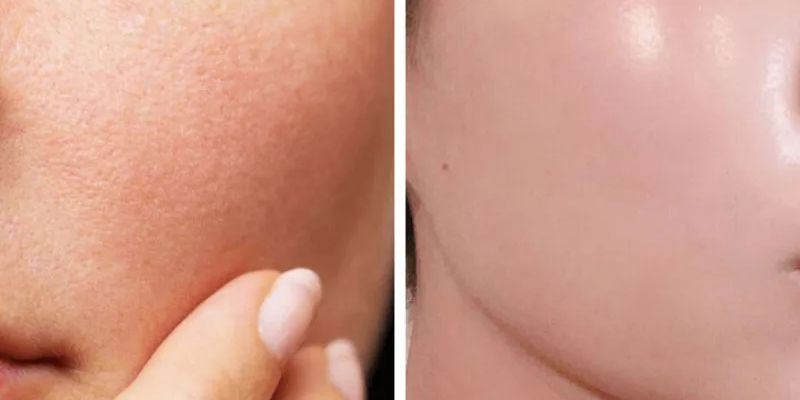 Chế Độ Ăn Uống Và Sinh Hoạt Khoa Học