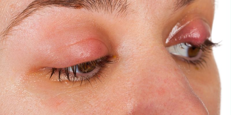 Khi Nào Cần Gặp Bác Sĩ?