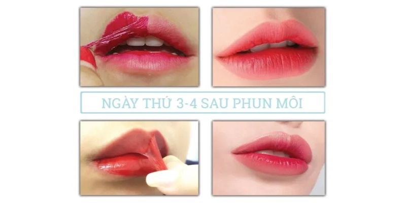 Quá Trình Bong Môi Sau Khi Phun