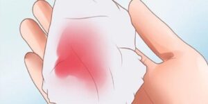 Ra Máu Màu Hồng Nhạt Là Gì?