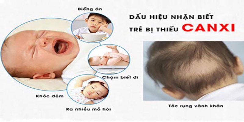 Dấu Hiệu Trẻ Sơ Sinh Bị Thiếu Canxi